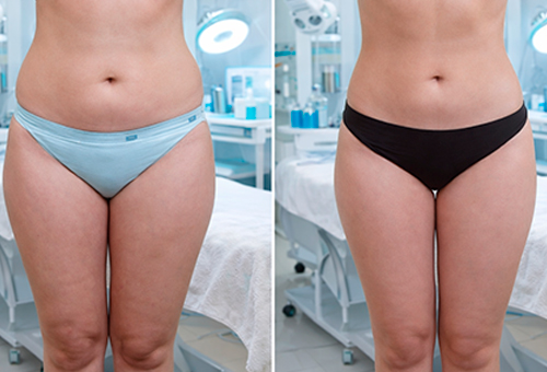 Результаты Обертывания