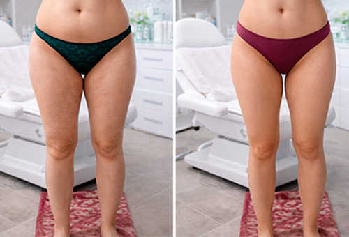 Результаты Обертывания