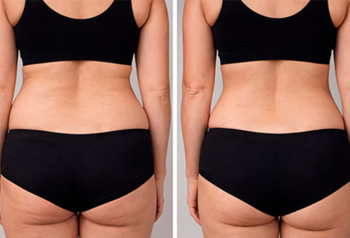 Результаты Обертывания