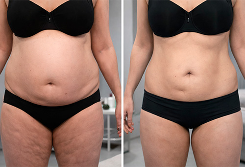 Результаты Обертывания