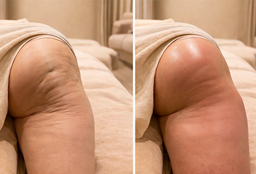 Результаты Обертывания