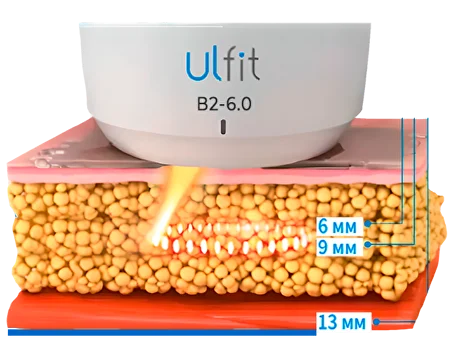 О процедуре