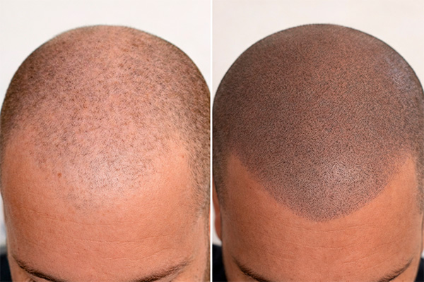 Результаты