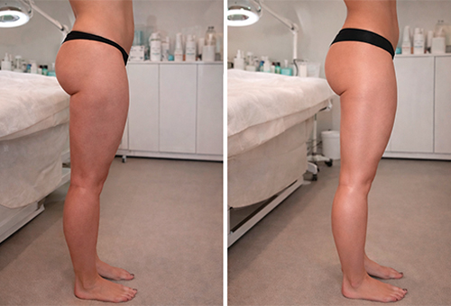 Результаты Обертывания