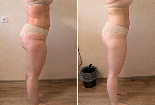 Результаты Обертывания