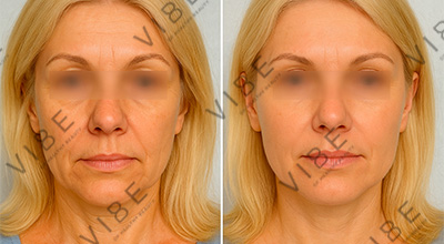 Результаты ручного массажа лица