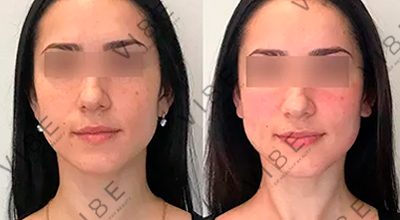 Результаты ручного массажа лица