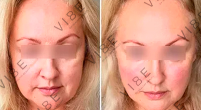 Результаты ручного массажа лица