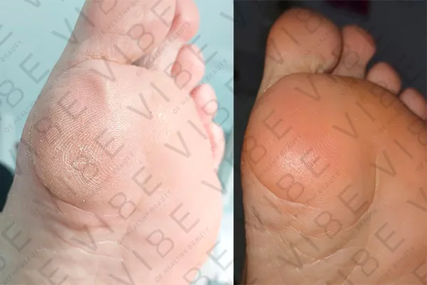 Результаты