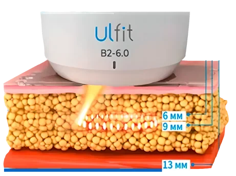 О процедуре