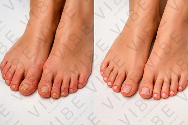 Результаты