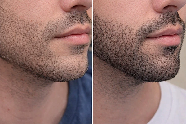 Результаты